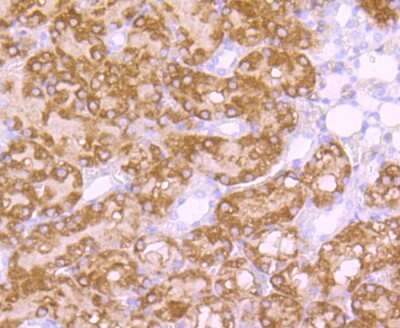 Immunohistochemistry-Paraffin: NHERF-1 Antibody (JJ0946) [NBP2-66981] - Analysis of paraffin-embedded rat kidney tissue using anti-EBP50 antibody. Counter stained with hematoxylin.