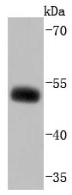 Western Blot: NHERF-1 Antibody (JJ0946) [NBP2-66981] - Analysis of EBP50 on MCF-7 cells lysates using anti-EBP50 antibody at 1/1,000 dilution.