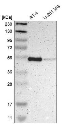 Western Blot: NHERF-1 Antibody [NBP1-84919] - Analysis in human cell line RT-4 and human cell line U-251 MG.