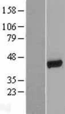 Western Blot: NHERF-1 Overexpression Lysate (Adult Normal) [NBL1-16198] Left-Empty vector transfected control cell lysate (HEK293 cell lysate); Right -Over-expression Lysate for NHERF-1.