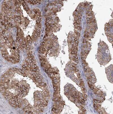 Immunohistochemistry-Paraffin NHLRC2 Antibody - BSA Free