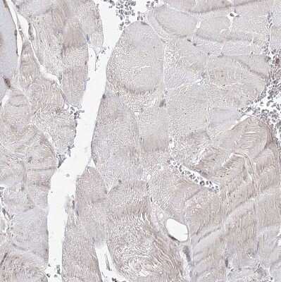 Immunohistochemistry-Paraffin NHLRC2 Antibody - BSA Free