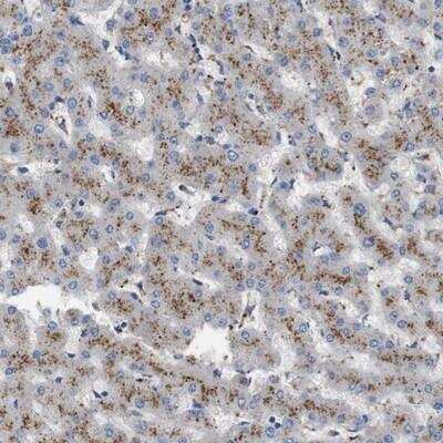 Immunohistochemistry-Paraffin: NHLRC3 Antibody [NBP1-86466] - Staining of human liver shows strong cytoplasmic positivity with granular pattern in hepatocytes.