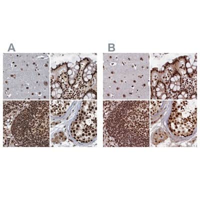 Immunohistochemistry-Paraffin: NHN1 Antibody [NBP1-82570] - Staining of human cerebral cortex, colon, lymph node and testis using Anti-ZC3H18 antibody NBP1-82570 (A) shows similar protein distribution across tissues to independent antibody NBP1-82571 (B).