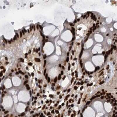 Immunohistochemistry-Paraffin: NHN1 Antibody [NBP1-82570] - Staining of human colon.