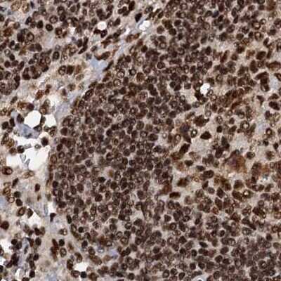 Immunohistochemistry-Paraffin: NHN1 Antibody [NBP1-82570] - Staining of human lymph node.