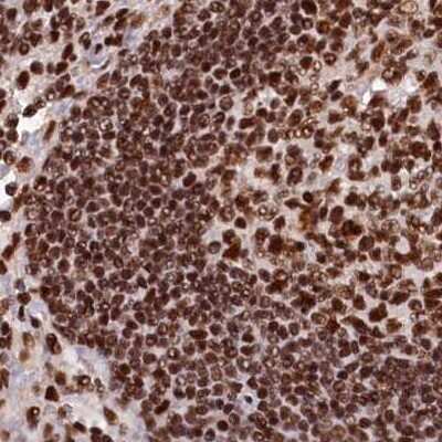 Immunohistochemistry-Paraffin: NHN1 Antibody [NBP1-82571] - Staining of human lymph node.