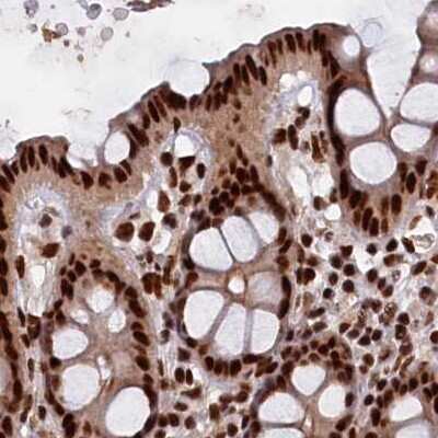 Immunohistochemistry-Paraffin: NHN1 Antibody [NBP1-82571] - Staining of human colon.