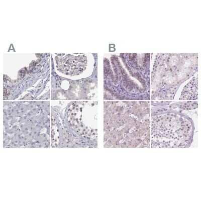 <b>Independent Antibodies Validation. </b>Immunohistochemistry-Paraffin: NHP2 Antibody [NBP2-38626] - Staining of human fallopian tube, kidney, liver and testis using Anti-NHP2 antibody NBP2-38626 (A) shows similar protein distribution across tissues to independent antibody NBP2-13656 (B).