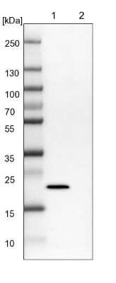 Western Blot: NHP2 Antibody [NBP2-13656] - Lane 1: NIH-3T3 cell lysate (Mouse embryonic fibroblast cells). Lane 2: NBT-II cell lysate (Rat Wistar bladder tumor cells).