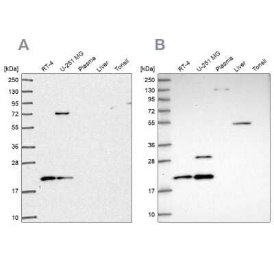 <b>Independent Antibodies Validation. </b>Western Blot: NHP2 Antibody [NBP2-38626] - Analysis using Anti-NHP2 antibody NBP2-38626 (A) shows similar pattern to independent antibody NBP2-13656 (B).