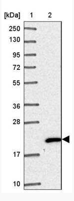 Western Blot NHP2 Antibody