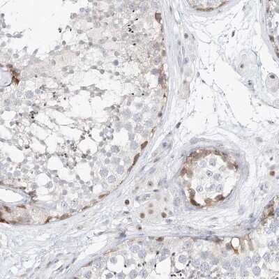 Immunohistochemistry-Paraffin: NHP2L1 Antibody [NBP1-89406] - Staining of human testis shows moderate nuclear positivity in Leydig and seminiferous ducts cells.