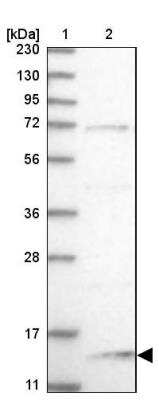 Western Blot: NHP2L1 Antibody [NBP1-89406] - Lane 1: Marker  [kDa] 230, 130, 95, 72, 56, 36, 28, 17, 11.  Lane 2: Human cell line RT-383