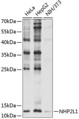 Western Blot: NHP2L1 Antibody [NBP2-93592] - Analysis of extracts of various cell lines, using NHP2L1 at 1:1000 dilution.Secondary antibody: HRP Goat Anti-Rabbit IgG (H+L) at 1:10000 dilution.Lysates/proteins: 25ug per lane.Blocking buffer: 3% nonfat dry milk in TBST.Detection: ECL Basic Kit .Exposure time: 5s.