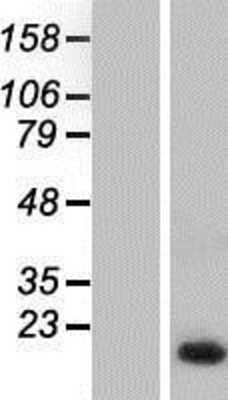 Western Blot: NHP2L1 Overexpression Lysate (Adult Normal) [NBP2-07801] Left-Empty vector transfected control cell lysate (HEK293 cell lysate); Right -Over-expression Lysate for NHP2L1.