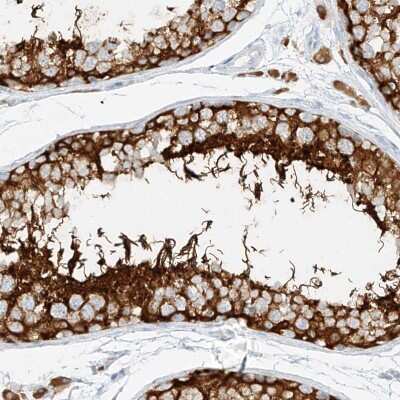 Immunohistochemistry: NHSL1 Antibody [NBP2-38149] - Staining of human testis shows strong cytoplasmic positivity in cells in seminiferus ducts.