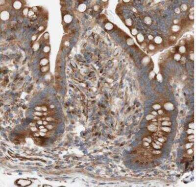 Immunohistochemistry-Paraffin: NICE-3 Antibody [NBP1-87986] - Staining of human colon shows strong cytoplasmic positivity in glandular cells.