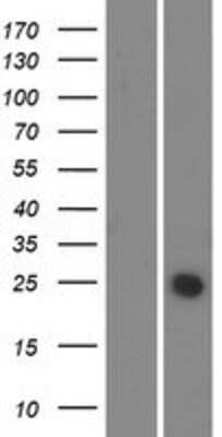 Western Blot NICE-3 Overexpression Lysate