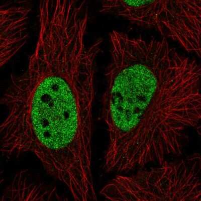 Immunocytochemistry/Immunofluorescence: NICN1 Antibody [NBP2-58328] - Staining of human cell line HeLa shows localization to nucleoplasm.