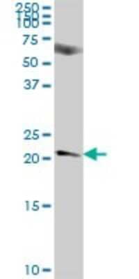 Western Blot: NICN1 Antibody [H00084276-B01P] - Analysis of NICN1 expression in human kidney.