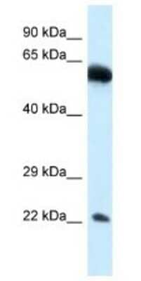 Western Blot: NICN1 Antibody [NBP1-79827] - 293T Cell Lysate 1ug/ml  Gel Concentration 12%