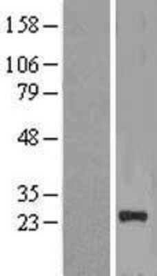 Western Blot: NICN1 Overexpression Lysate (Adult Normal) [NBL1-13640] Left-Empty vector transfected control cell lysate (HEK293 cell lysate); Right -Over-expression Lysate for NICN1.