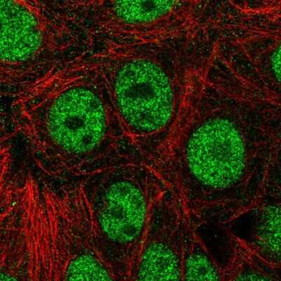 Immunocytochemistry/ Immunofluorescence NIF1 Antibody - BSA Free