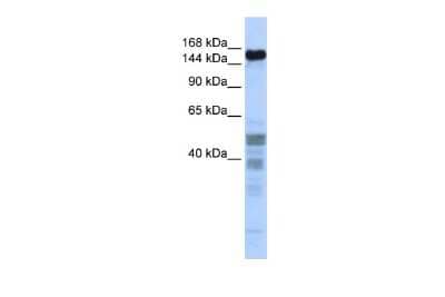 Western Blot: NIF1 Antibody [NBP3-10511] - Western blot analysis using NBP3-10511 on Human Brain  as a positive control. Antibody Titration: 0.2-1 ug/ml