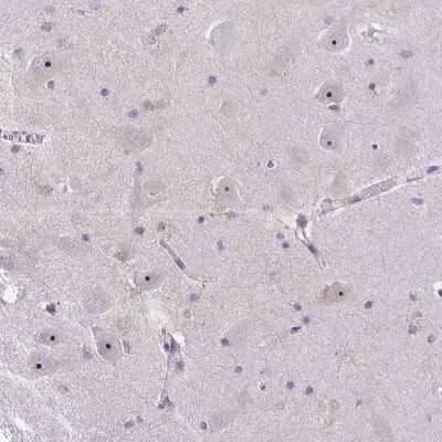 Immunohistochemistry: NIFK Antibody [NBP2-48643] - Staining of human hippocampus shows moderate nucleolar positivity in neuronal cells.