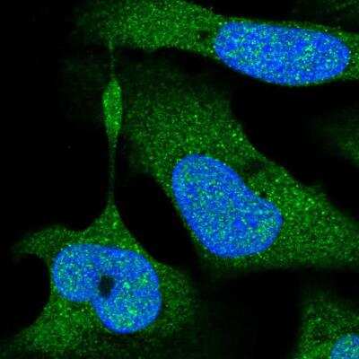 Immunocytochemistry/Immunofluorescence: NIK/MAP3K14 Antibody [NBP1-83413] - Staining of human cell line U-2 OS shows localization to nucleus, nucleoli fibrillar center, cytosol & vesicles. Antibody staining is shown in green.