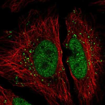 Immunocytochemistry/Immunofluorescence: NIP30 Antibody [NBP2-55946] - Staining of human cell line HeLa shows localization to nucleoplasm & vesicles.
