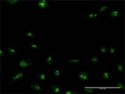 Immunocytochemistry/Immunofluorescence: NIP7 Antibody [H00051388-B03P] - Analysis of purified antibody to NIP7 on HeLa cell. Antibody concentration 10 ug/ml