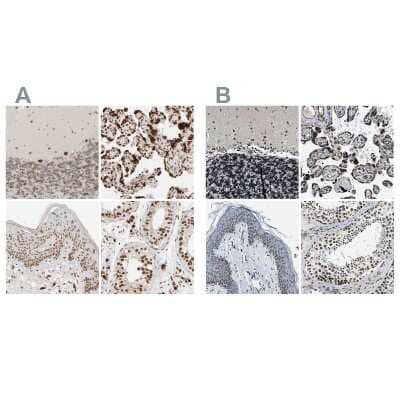 Immunohistochemistry-Paraffin: NIPA Antibody [NBP1-82564] - Staining of human cerebellum, placenta, skin and testis using Anti-NIPA antibody NBP1-82564 (A) shows similar protein distribution across tissues to independent antibody NBP1-82565 (B).