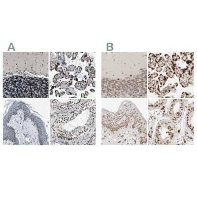 <b>Independent Antibodies Validation. </b>Immunohistochemistry-Paraffin: NIPA Antibody [NBP1-82565] - Staining of human cerebellum, placenta, skin and testis using Anti-NIPA antibody NBP1-82565 (A) shows similar protein distribution across tissues to independent antibody NBP1-82564 (B).