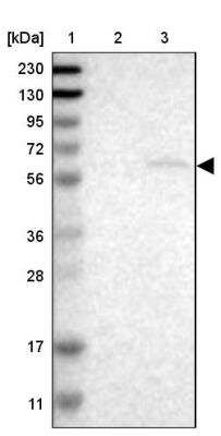 Western Blot: NIPA Antibody [NBP1-82565] - Lane 1: Marker  [kDa] 230, 130, 95, 72, 56, 36, 28, 17, 11.  Lane 2: Human cell line RT-4.  Lane 3: Human cell line U-251MG sp