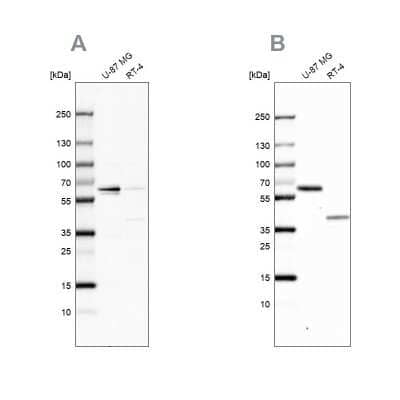 Western Blot: NIPA Antibody [NBP1-82565] - Analysis using Anti-ZC3HC1 antibody NBP1-82565 (A) shows similar pattern to independent antibody NBP1-82564 (B).