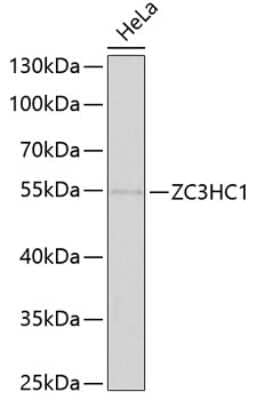 Western Blot: NIPA Antibody [NBP2-93865] - Analysis of extracts of HeLa cells, using NIPA .Exposure time: 90s.