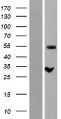 Western Blot: NIPA Overexpression Lysate (Adult Normal) [NBP2-07034] Left-Empty vector transfected control cell lysate (HEK293 cell lysate); Right -Over-expression Lysate for NIPA.