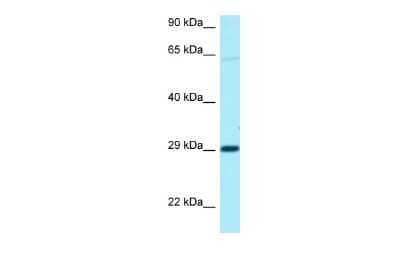 Western Blot: NIPA1 Antibody [NBP2-83269] - WB Suggested Anti-NIPA1 Antibody. Titration: 1.0 ug/ml. Positive Control: 721_B Whole Cell