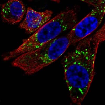 Immunocytochemistry/Immunofluorescence: NIPA2 Antibody [NBP2-56387] - Staining of human cell line PC-3 shows localization to the Golgi apparatus.