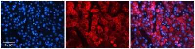 Immunohistochemistry: NIPA2 Antibody [NBP1-91580] - Formalin Fixed Paraffin Embedded Tissue: Human Liver Tissue Observed Staining: Cytoplasm and plasma membrane in hepatocytes Primary Antibody Concentration: 1:100 Other Working Concentrations: 1:600 Secondary Antibody: Donkey anti-Rabbit-Cy3 Secondary Antibody Concentration: 1:200 Magnification: 20X Exposure Time: 0.5 - 2.0 sec