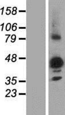 Western Blot: NIPAL3 Overexpression Lysate (Adult Normal) [NBP2-06639] Left-Empty vector transfected control cell lysate (HEK293 cell lysate); Right -Over-expression Lysate for NIPAL3.