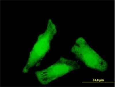 Immunocytochemistry/Immunofluorescence: NIPBL Antibody (3B9) [H00025836-M01] - Analysis of monoclonal antibody to NIPBL on HeLa cell . Antibody concentration 10 ug/ml.