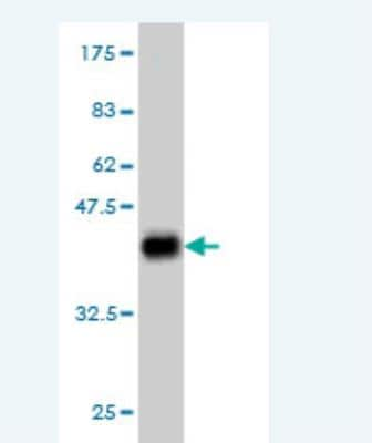 Western Blot: NIPBL Antibody (3B9) [H00025836-M01] - Detection against Immunogen (37.73 KDa) .