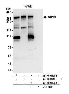 <b>Independent Antibodies Validation. </b>Immunoprecipitation: NIPBL Antibody [NB100-93320] - Detection of human NIPBL by western blot of immunoprecipitates. Samples: Whole cell lysate (1.0 mg per IP reaction; 20% of IP loaded) from HeLa cells. Antibodies: Affinity purified rabbit anti-NIPBL antibody NB100-93320 (lot 4) used for IP at 3 ug per reaction. NIPBL was also immunoprecipitated by a previous lot of this antibody (lot 3) and rabbit anti-NIPBL antibody NB100-93319. For blotting immunoprecipitated NIPBL, NB100-93320 was used at 0.4 ug/ml. Detection: Chemiluminescence with an exposure time of 10 seconds.