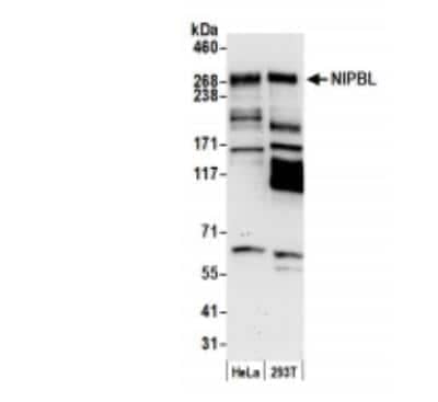 Western Blot: NIPBL Antibody [NB100-93320] - Whole cell lysate (15 ug) from HeLa and 293T cells prepared using NETN lysis buffer. Antibody: Affinity purified rabbit anti-NIPBL antibody used for WB at 0.1 ug/ml. Detection: Chemiluminescence with an exposure time of 3 seconds.