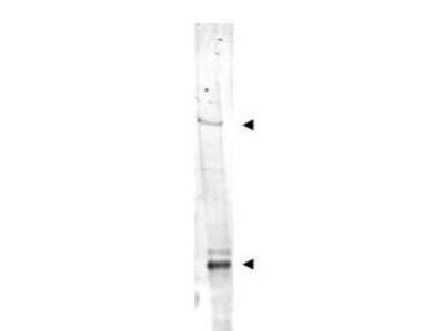 Western Blot: NIPBL Antibody [NBP1-77974] - Shows detection of bands at ~315 kDa and ~125 kDa corresponding to isoforms of IDN3 (arrow-heads) in mouse heart whole cell tissue extract. Approximately 35 ug of lysate was separated on a 4-8% gel by SDS-PAGE and transferred onto nitrocellulose. After blocking the membrane was probed with the primary antibody diluted to 1:1,500. Reaction occurred overnight at 4h followed by washes and reaction with a 1:20,000 dilution of IRDye (TM) 800 conjugated Rb-a-Goat IgG [H&L] MXHu for 45 min at room temperature.