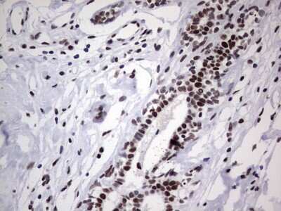 Immunohistochemistry: NIPP1 Antibody (4E5) [NBP2-45386] - Analysis of Human breast tissue. (Heat-induced epitope retrieval by 1 mM EDTA in 10mM Tris, pH8.5, 120C for 3min)