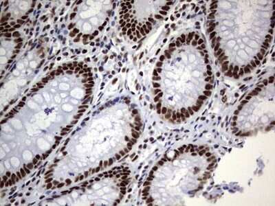 Immunohistochemistry: NIPP1 Antibody (4E5) [NBP2-45386] - Analysis of Human colon tissue. (Heat-induced epitope retrieval by 1 mM EDTA in 10mM Tris, pH8.5, 120C for 3min)